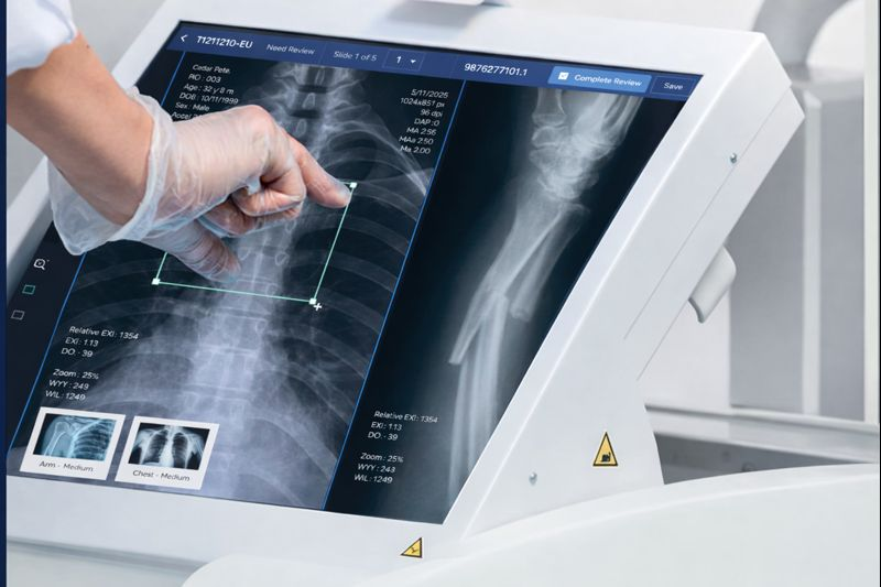 Touch-first capture interface (placeholder)