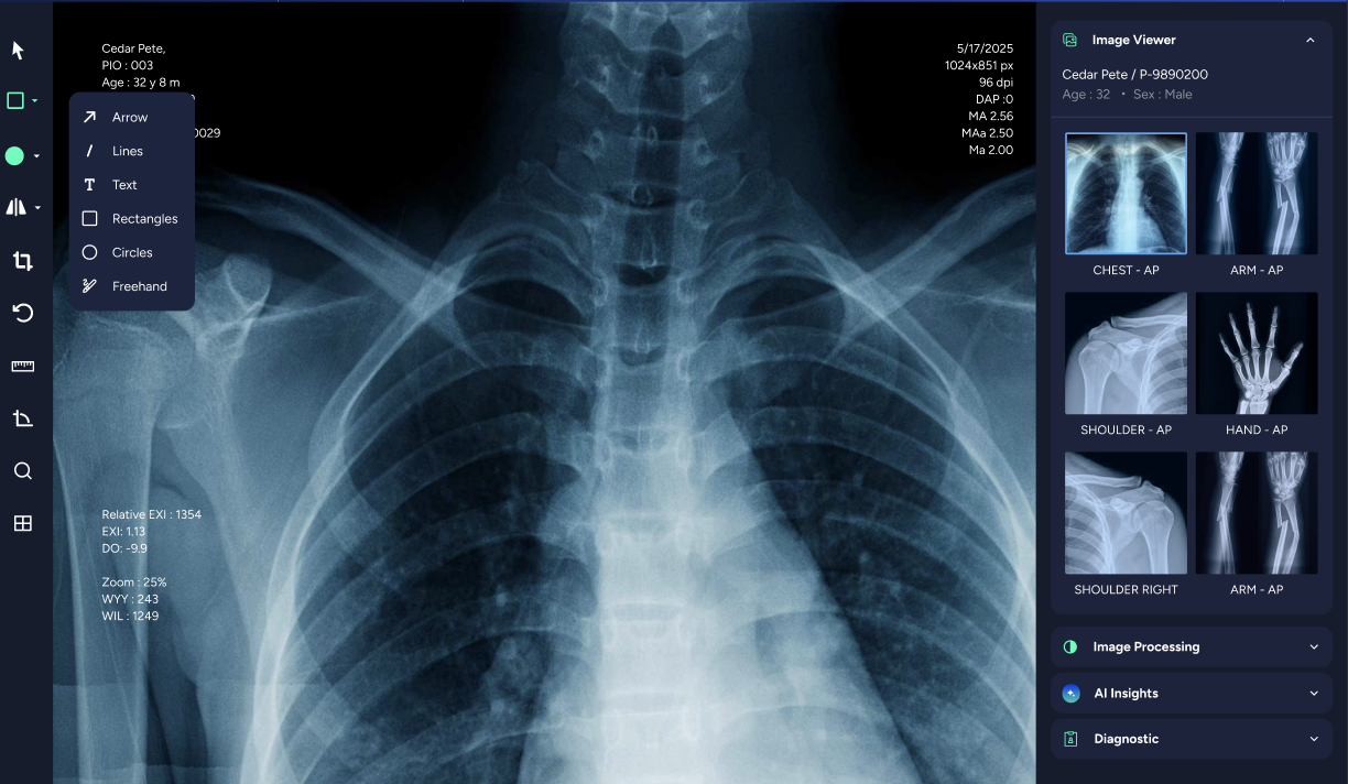 X-ray viewer interface (placeholder)